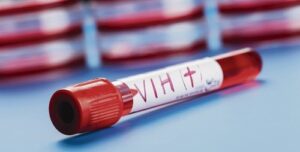 Sector Salud no realiza prevención de VIH en comunidad LGTB