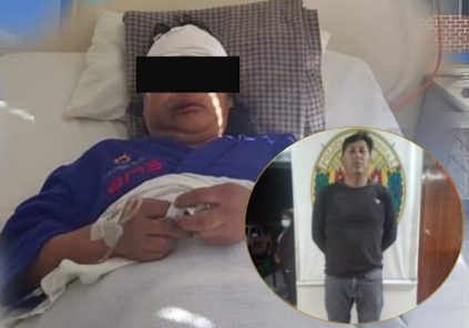 Arequipa: prisión preventiva a sujeto que golpeó con combo en la cabeza a su exconviviente