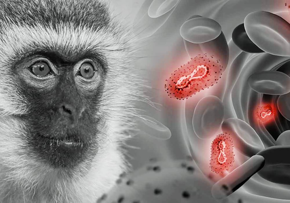 Viruela del mono en Arequipa: Minsa detecta 4 nuevos contagios en 24 horas